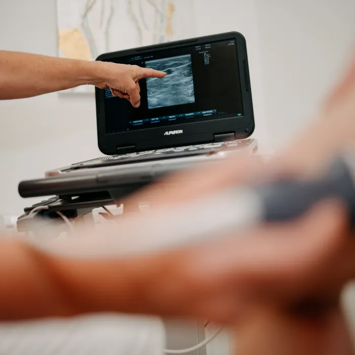 Lézeres visszérműtét