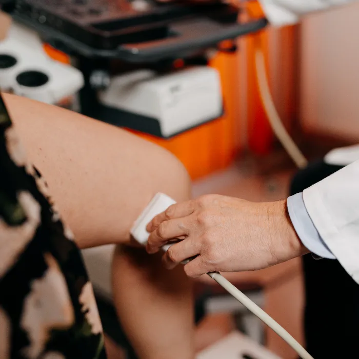 Mikrohullámú visszérműtét