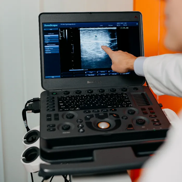 Ultrahang-diagnosztika